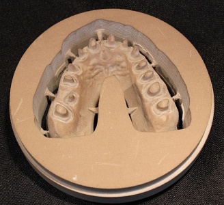 Execution of dental model